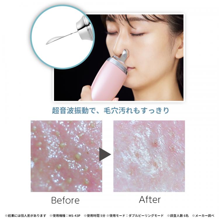 春先取りの 新品 未開封 ヤーマン ミーゼ ディープスキンクリア MS-43P ...