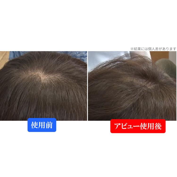 クレイツイオン ブラシアイロン アビュー／ブラシ型ヘアアイロン